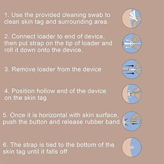 PAINLESS AUTO SKIN TAG  REMOVER KIT