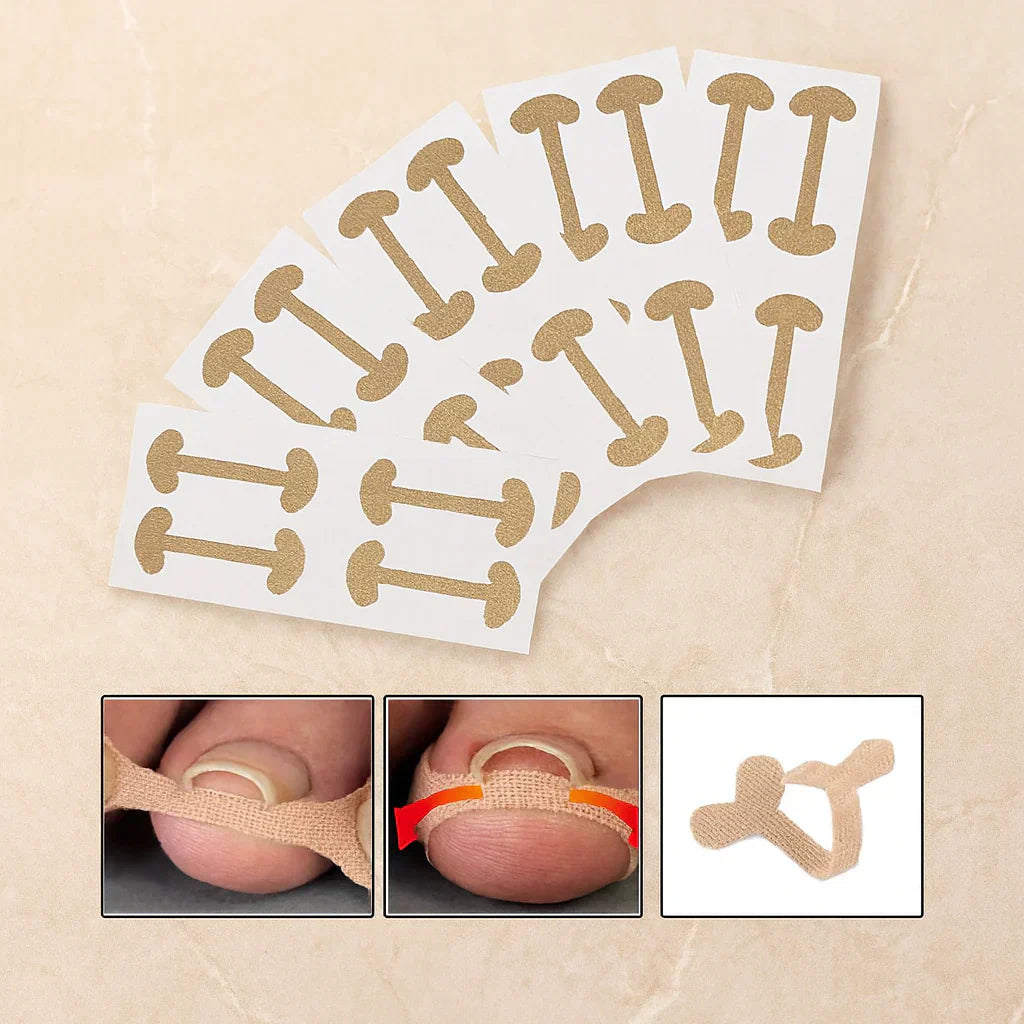 Toenail Correction Strips